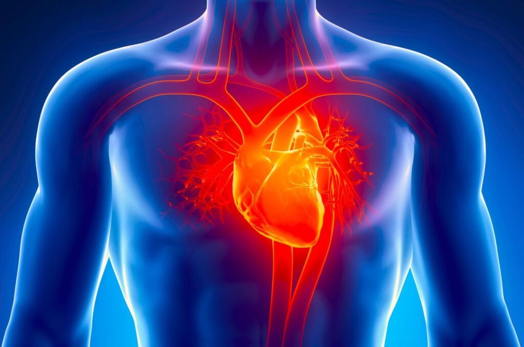 Cardiac Catheterization