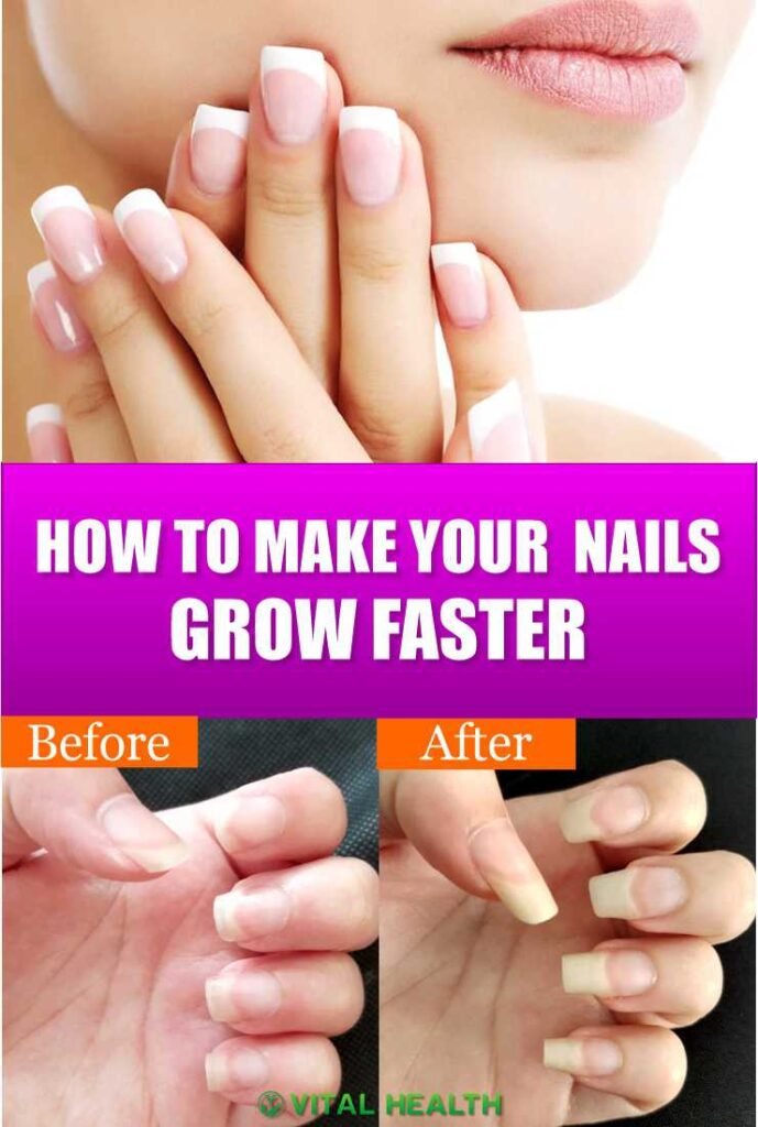 grow nails faster