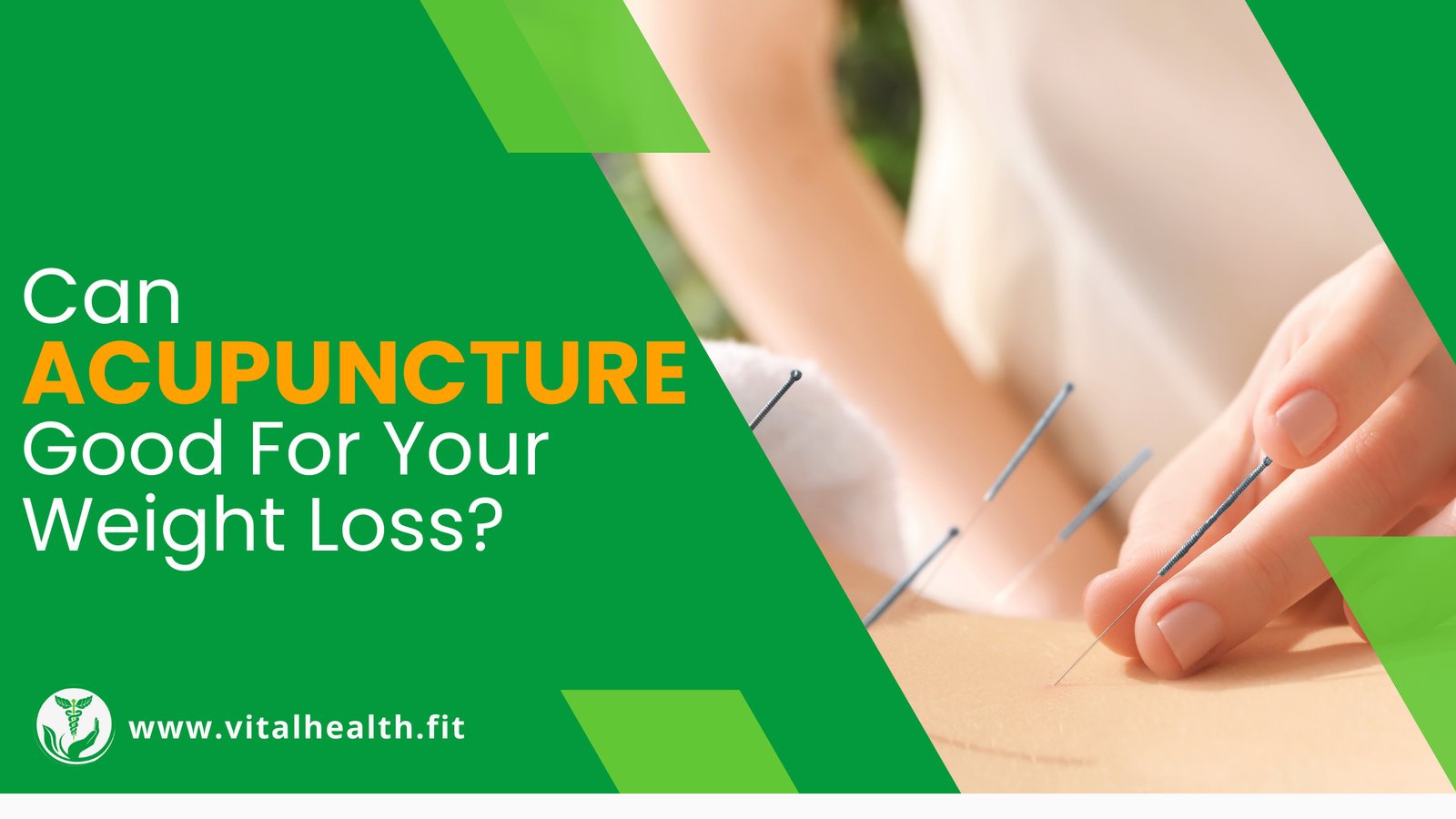 Read more about the article [2023 Update] Can Acupuncture Support Your Weight Loss Journey ?     