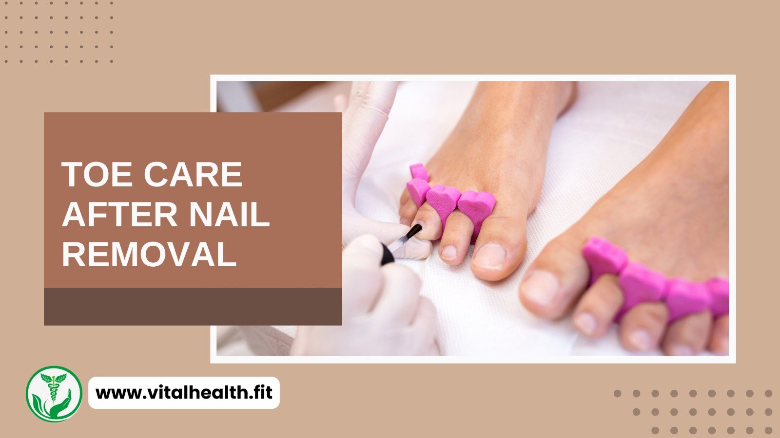 Read more about the article [2024 Update] Toe Care After Nail Removal