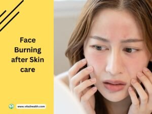 Read more about the article face burning after skin care[2024 update]